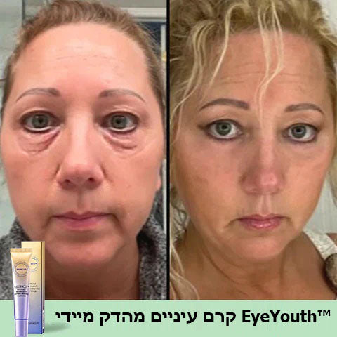 EyeYouth™ | קרם מיידי למתיחת העיניים