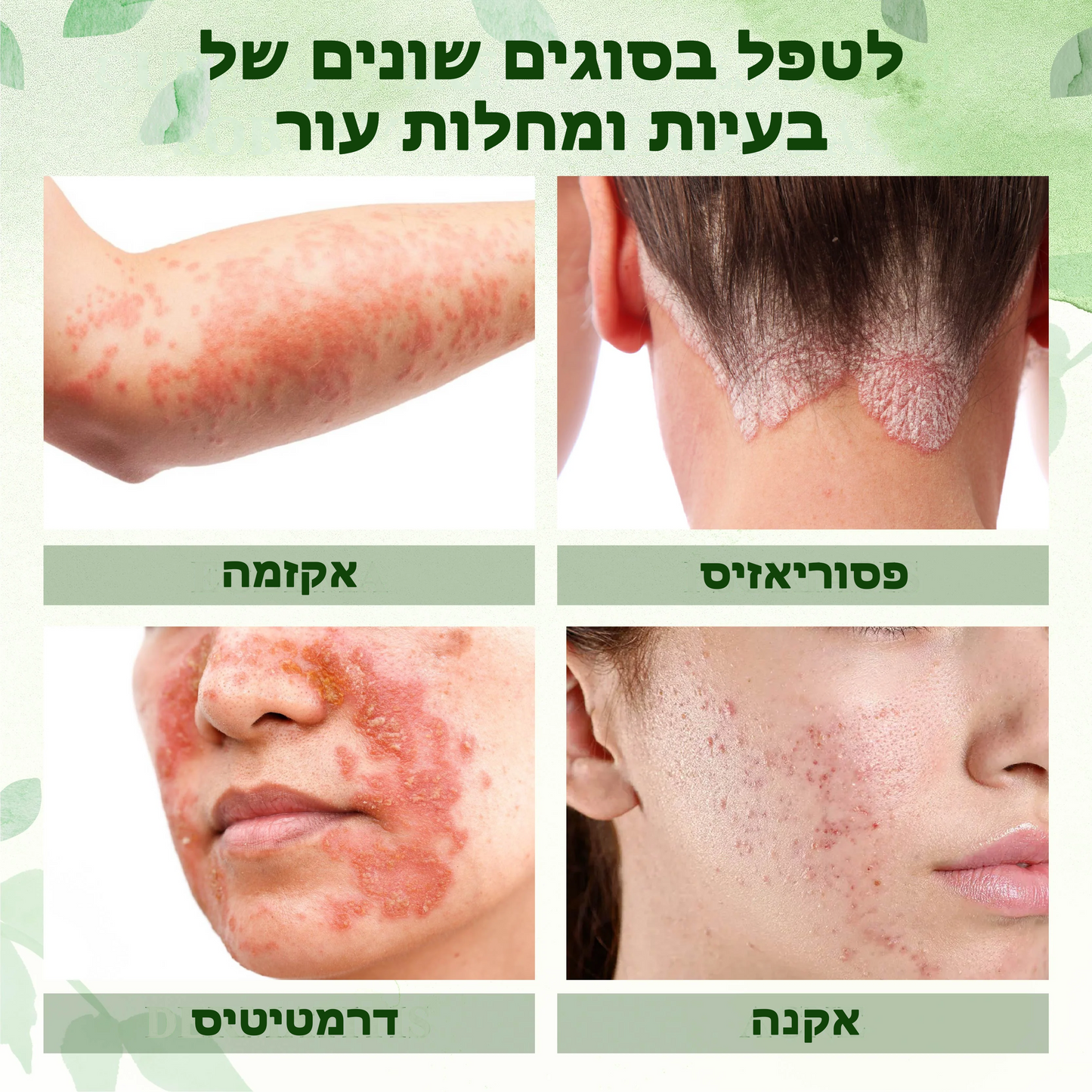 HerbalGel™ | משחת תיקון עור מצמח הכוכבית