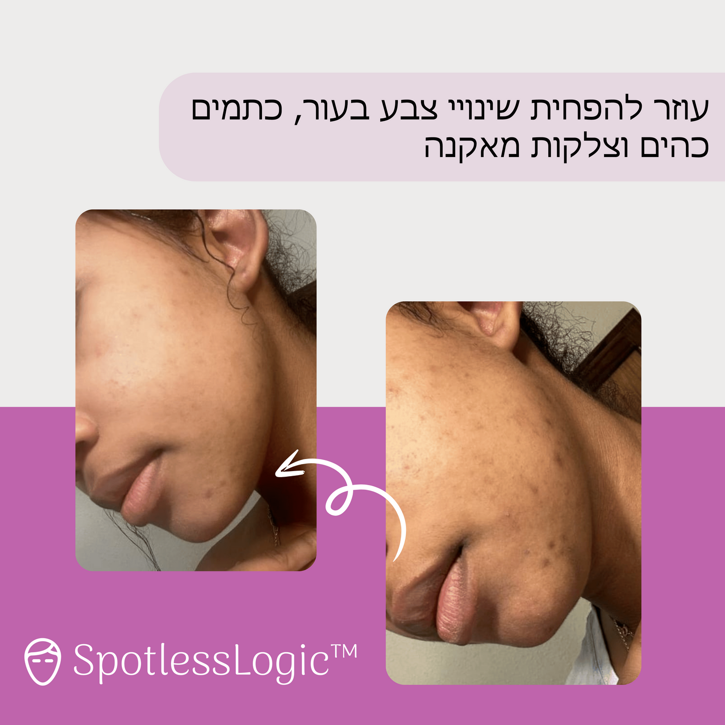 SpotlessLogic