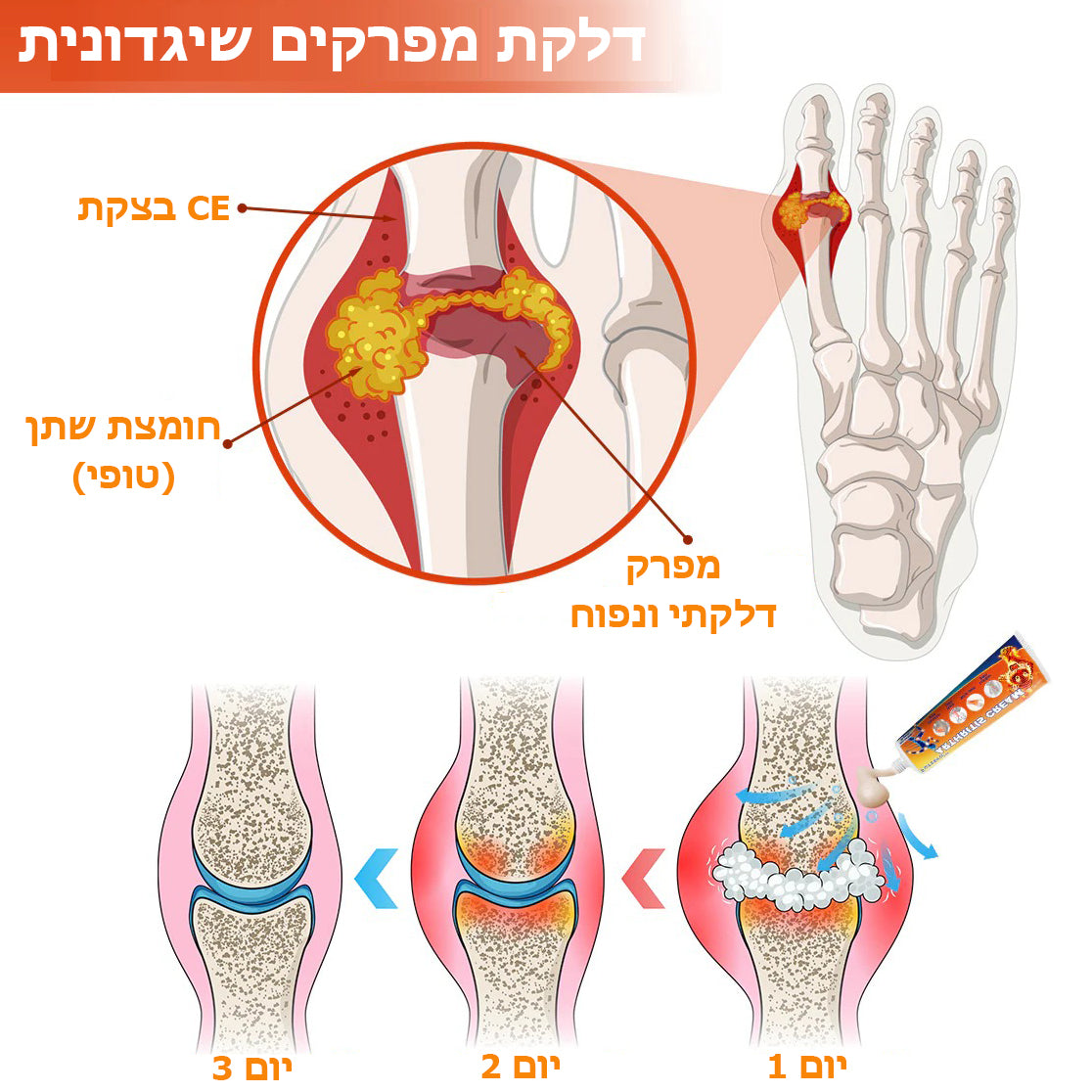 TigerSoothe™ | קרם להקלה מדלקת מפרקים