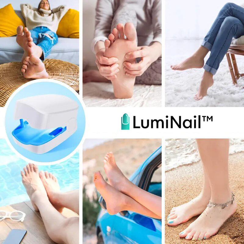 LumiNail™ | מכשיר תרפיה באור למחלות ציפורניים