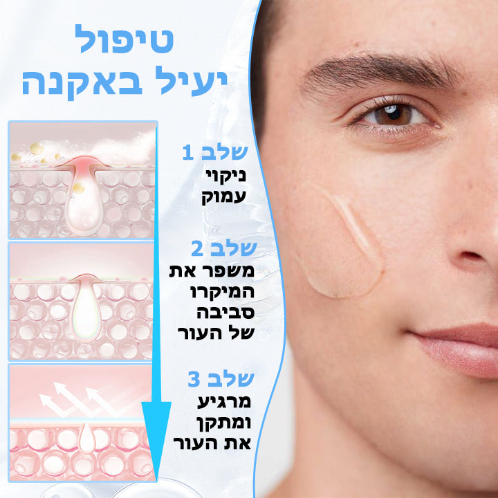 PoresClear™ | נוזל התחדשות עור 2% BHA
