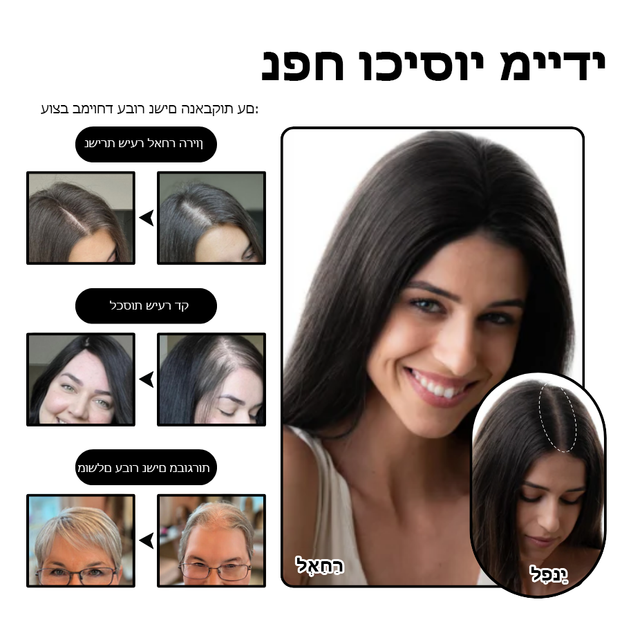 ClipCrown™ | טופר שיער קליפס טבעי