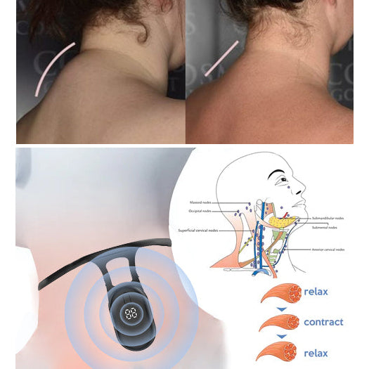 NeckSonic™ | מכשיר אולטרסוני להרגעת הצוואר והלימפה