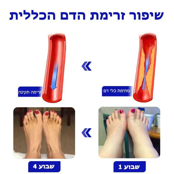 NumbStop™ | ספריי נגד נימול לידיים ורגליים
