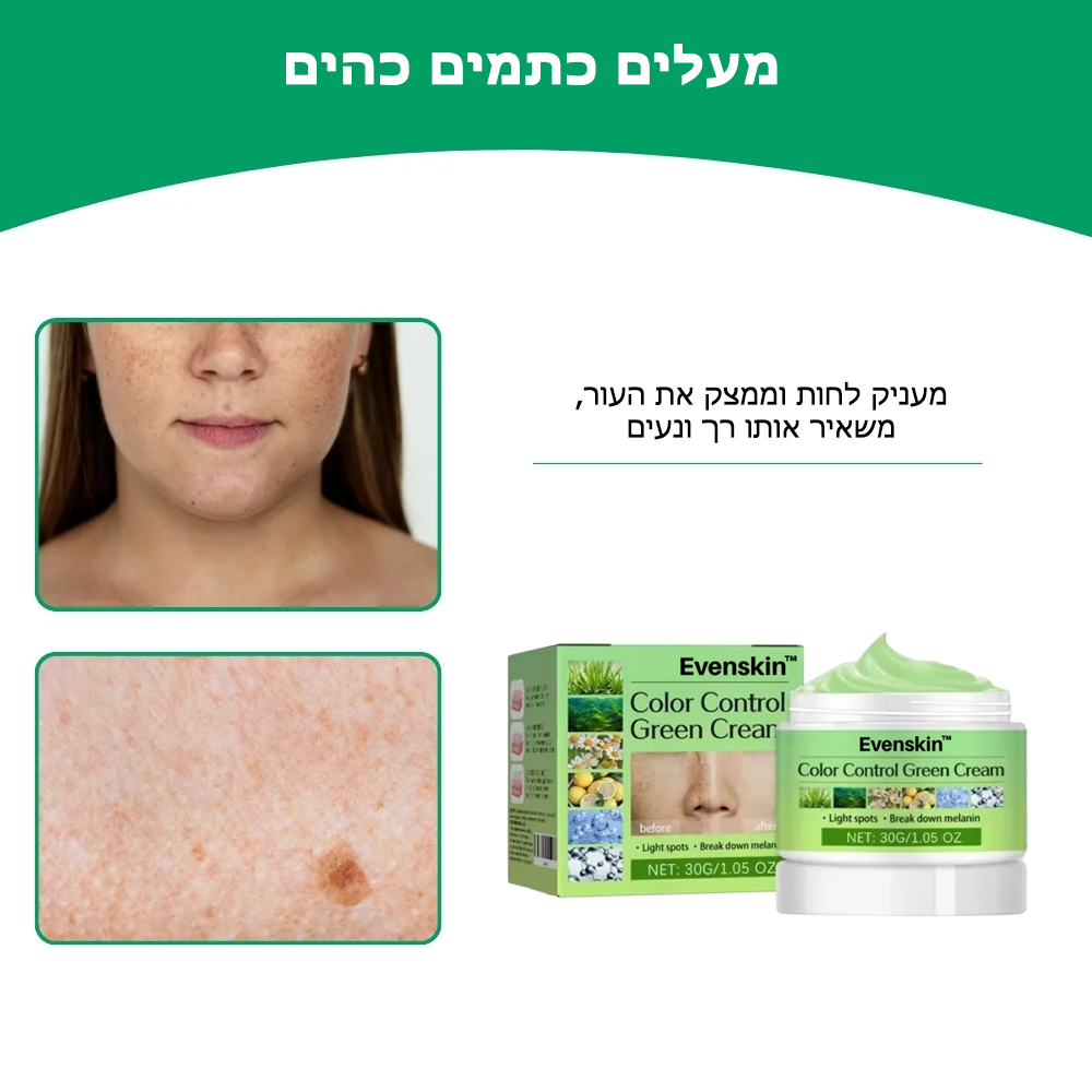 Evenskin™ | קרם לטיפול בכתמי עור