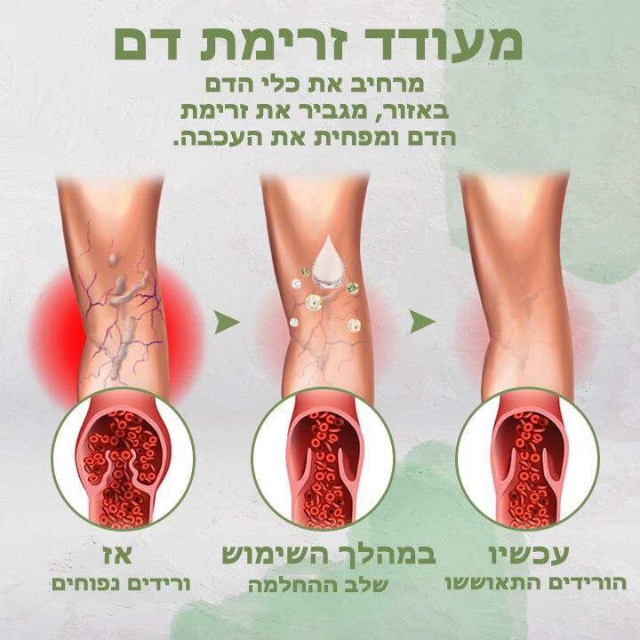 VeinClear™ | טיפול בוורידים ורידים