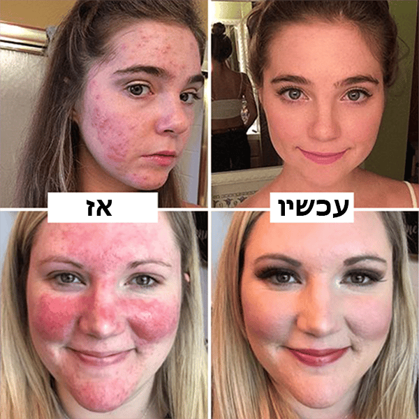 PerfectGlow™ | קרם הסוואה מקצועי לאיפור