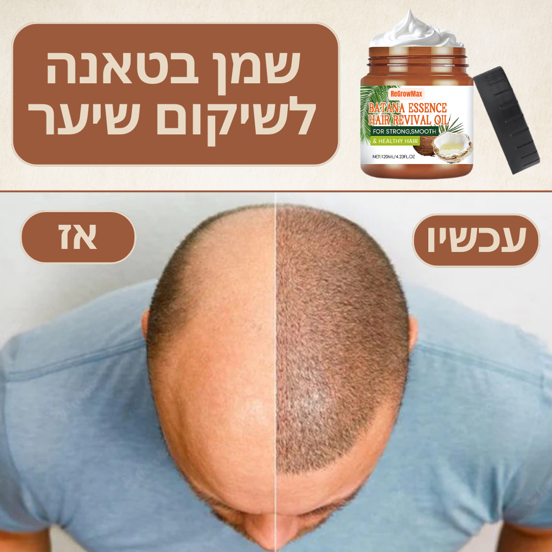 ReGrowMax™ | המוצר האחרון לצמיחת שיער שתצטרך אי פעם!