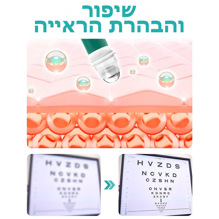 Eyevolve™ | מעגל עיניים לשיפור הראייה