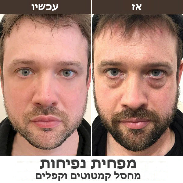 HydraMan™ | מומחה לגברים פרו הידרה אנרג'טיק רולר לעיניים