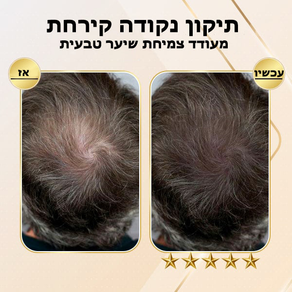 GingerGrow™ | סבון שמפו לצמיחת שיער בזנגביל