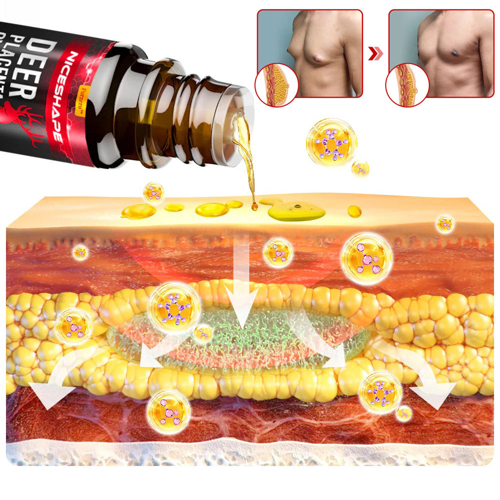 GynoGone™ | שמן עיסוי לגינקומסטיה מפלצנטת איילים