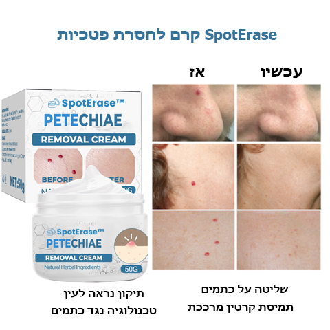 SpotErase™ | קרם להסרת פטכיות