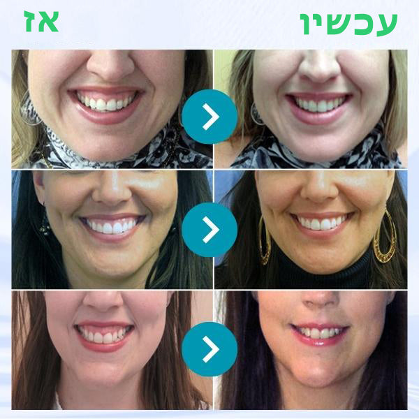 PerfectTeeth™ | ג'ל לטיפול בחניכיים