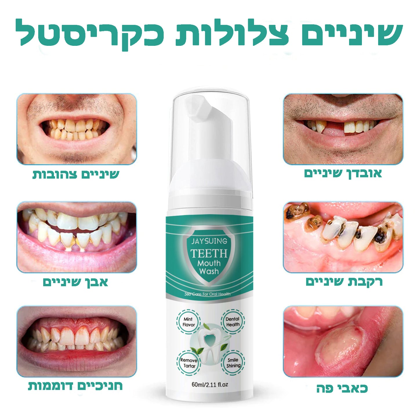 OralCare™ | מי פה לכל בעיות הפה