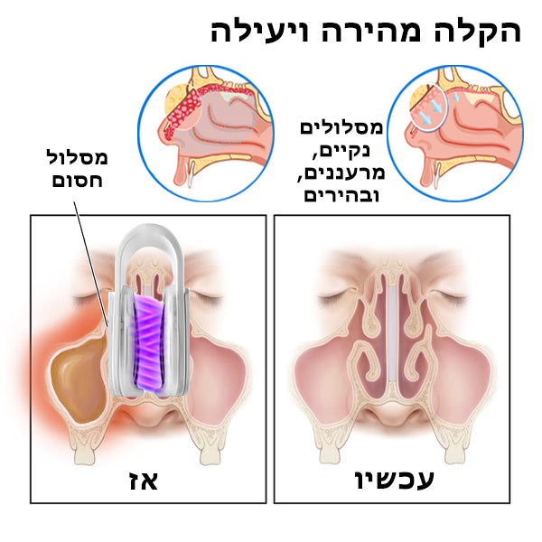 SinuClearPro™ | מכשיר ניקוי ריר האף