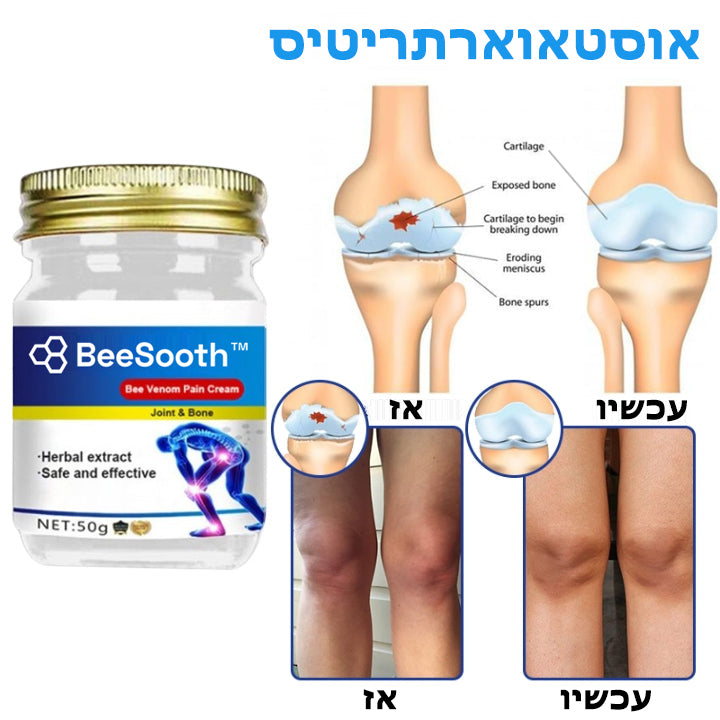 BeeSooth™ | קרם ריפוי לכאבי מפרקים ועצמות ברעל דבורה