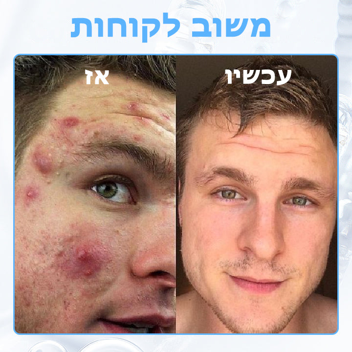 PoresClear™ | נוזל התחדשות עור 2% BHA