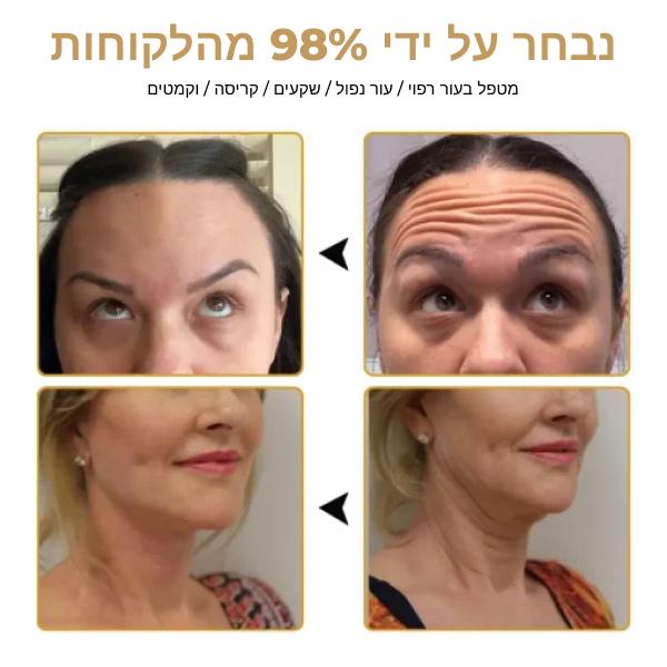 VenoGlow™ | קרם בוטוקס עם ארס דבורים נגד קמטים
