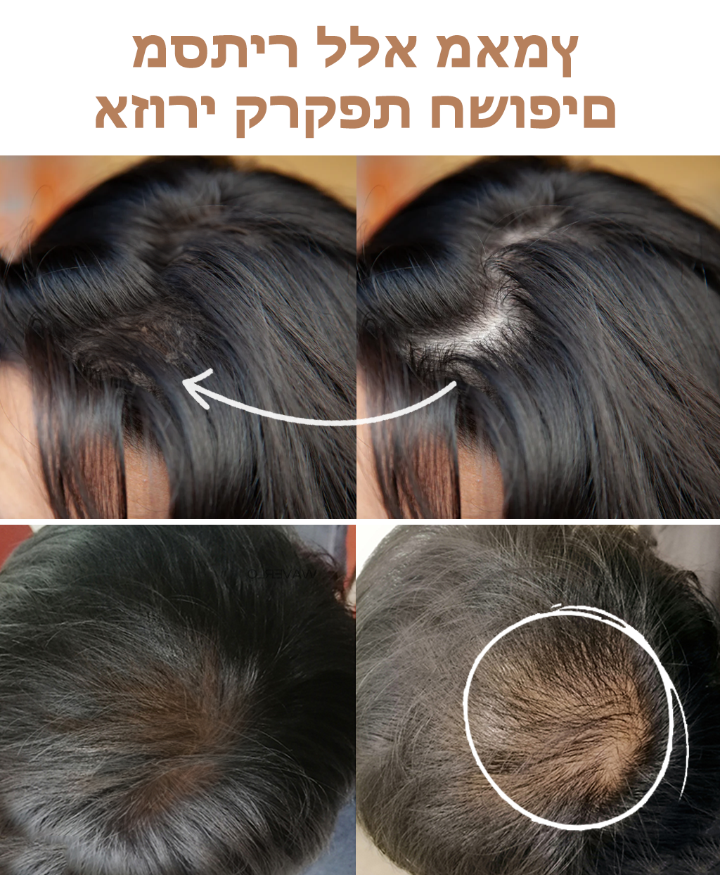 ShadeMagic™ | כיסוי שורש קסם