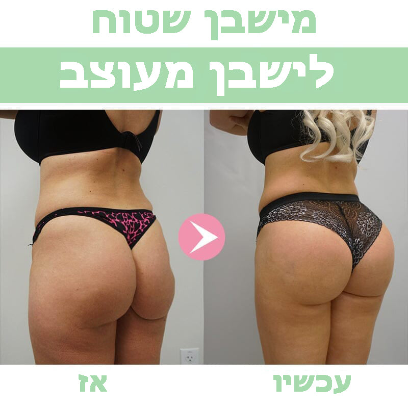 ButtBoost™ | קרם שיפור ישבן