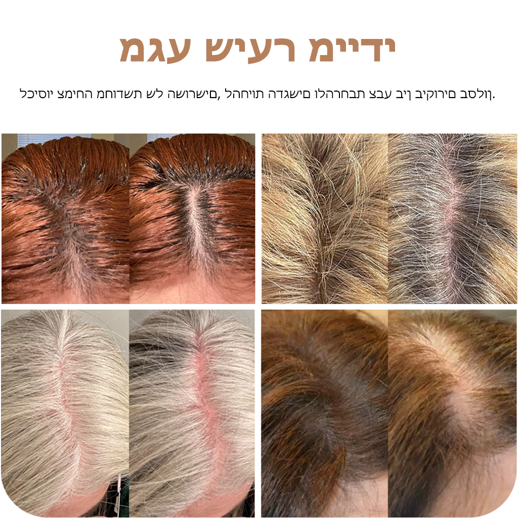 ShadeMagic™ | כיסוי שורש קסם