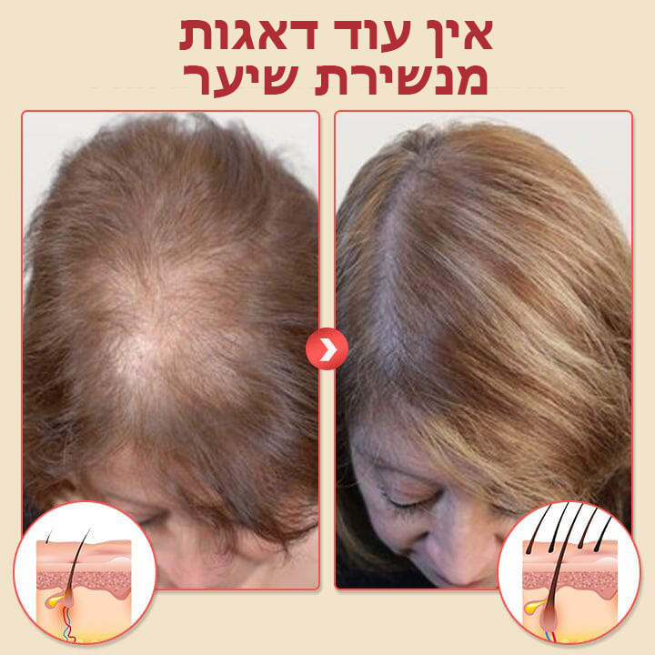 HairReborn™ | שמפו מקציף להחייאת השיער