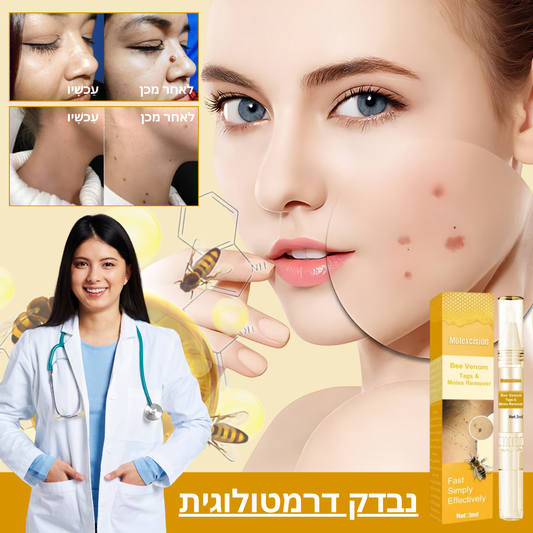Molexcision™ | היפטר משומות ותגיות עור באופן מיידי