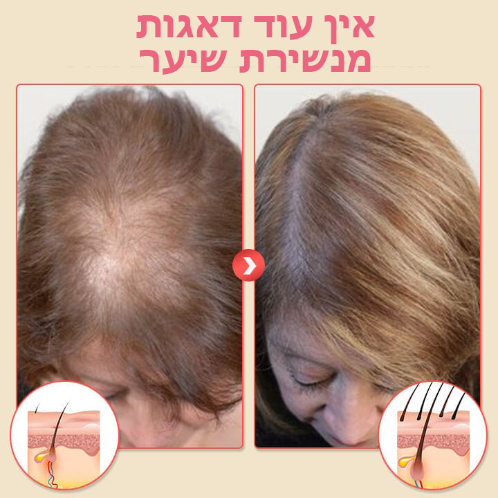 HairRenew™ | שמפו מקציף לחידוש שיער