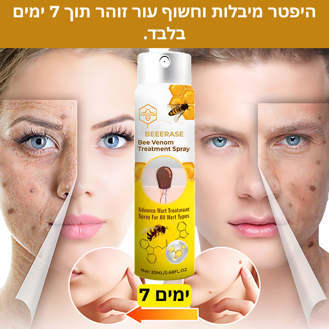 BeeErase™ | הסר יבלות וחשוף עור נקי תוך 7 ימים בלבד!