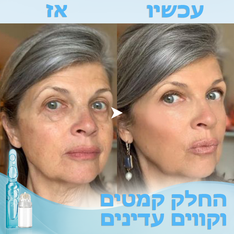 MicroLift™ | מערכת מיקרו-אינפוזיה לניקוב עם סרום אנטי-אייג'ינג