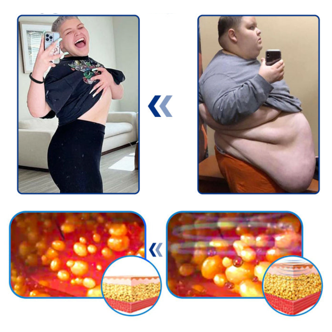 LymphPulse™ | מגביר ניקוז לימפה ומנקה רעלים תוך 3 ימים!