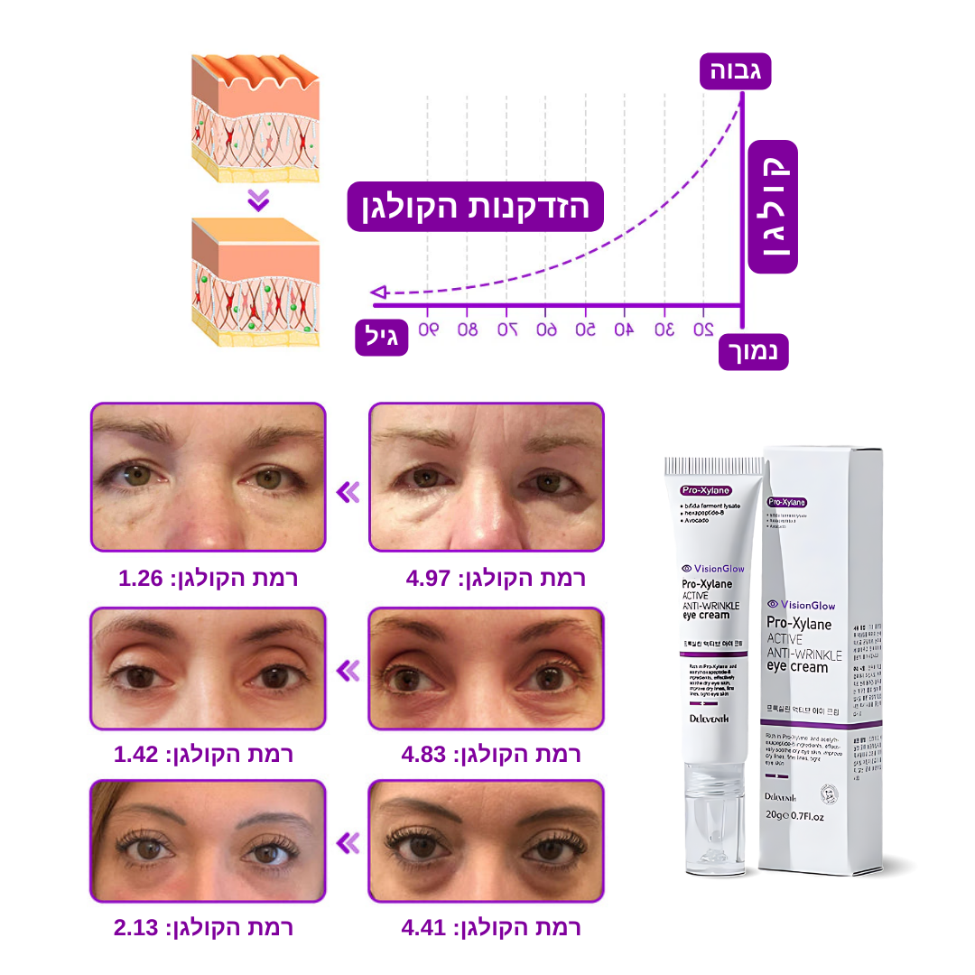VisionGlow™ | הסרת שקיות עיניים רק 10 דקות