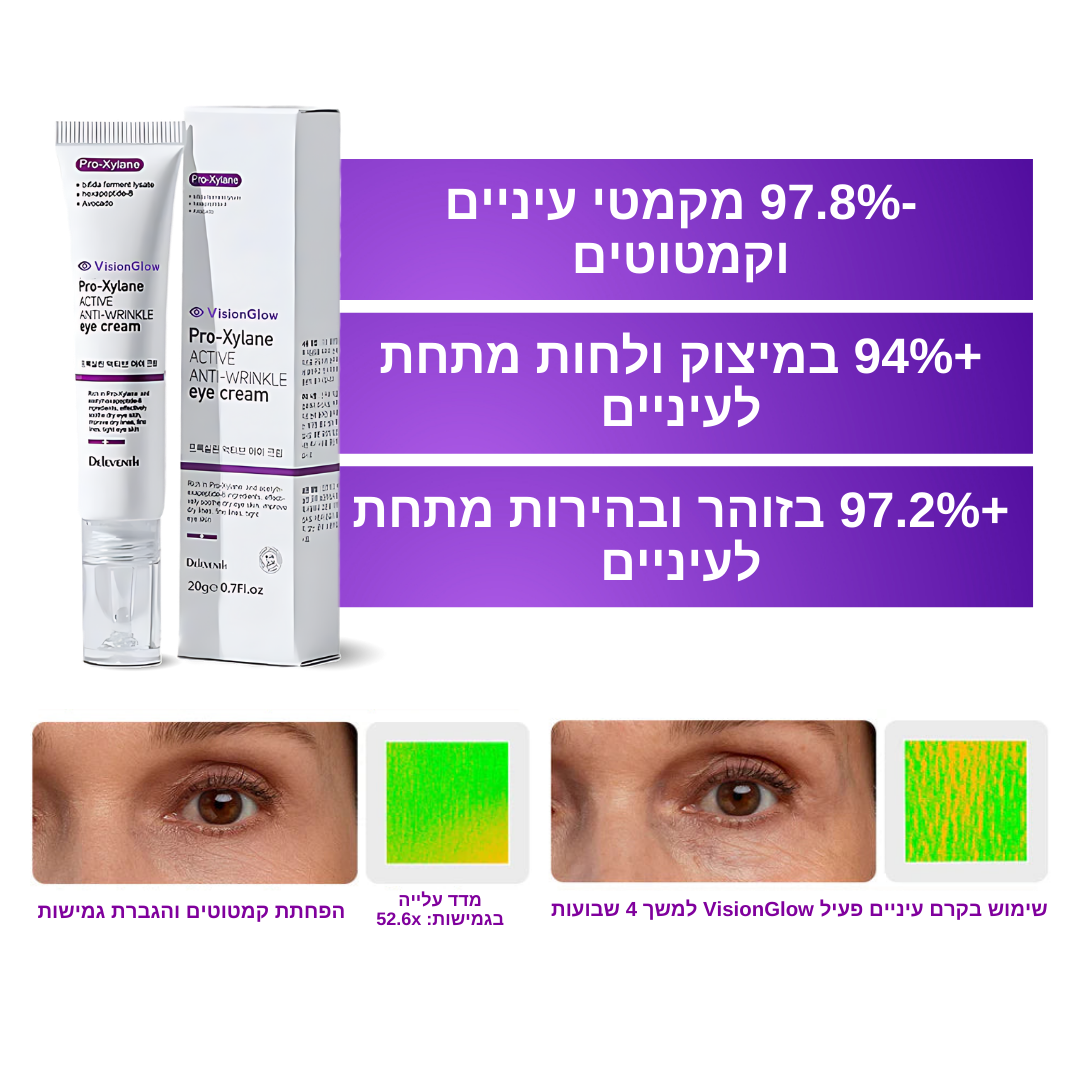 VisionGlow™ | הסרת שקיות עיניים רק 10 דקות