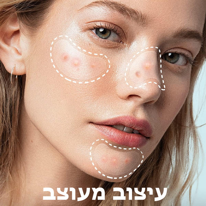 AcneCure™ | טלאים לטיפול באקנה הידרוקולואידיים ללילה