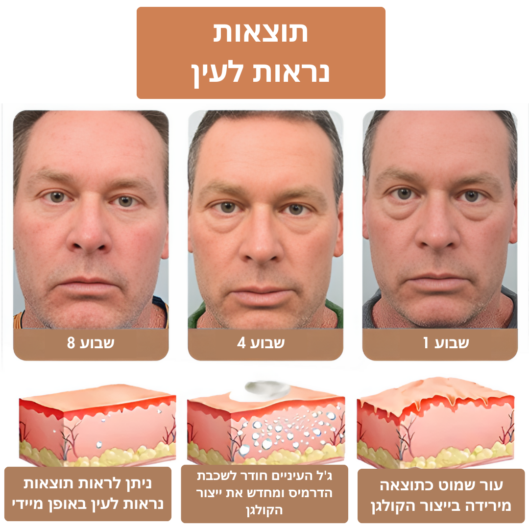 YouthfulGaze™ | להרים ולהדק את עפעפייך מיידית – אין יותר צניחה