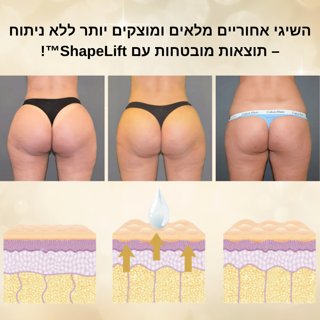 ShapeLift™ | ישבן מלא ומוצק יותר תוך 7 ימים!