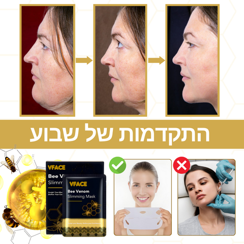 VFace™ | השג קו לסת מפוסל תוך 10 דקות בלבד!