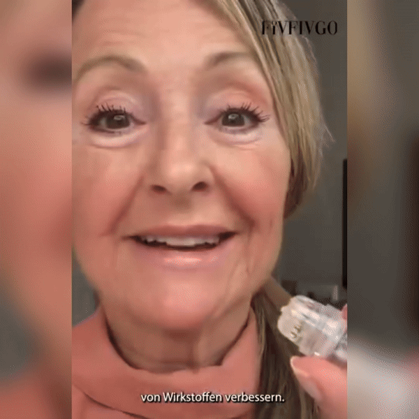 MicroGlow™ | חבילת Microneedling Collagen Rebounce