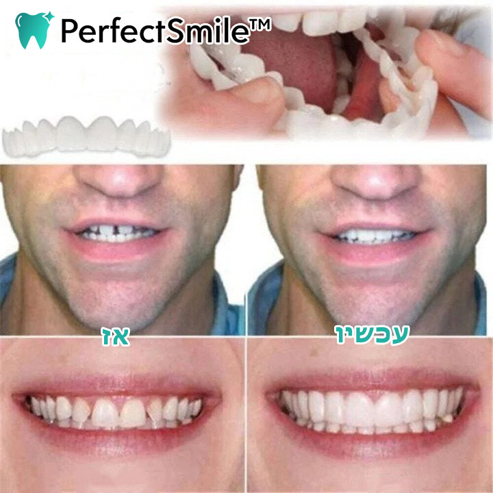 PerfectSmile™ | סיכת שיניים