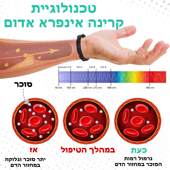 GlucOff™ | צמיד מווסת סוכר