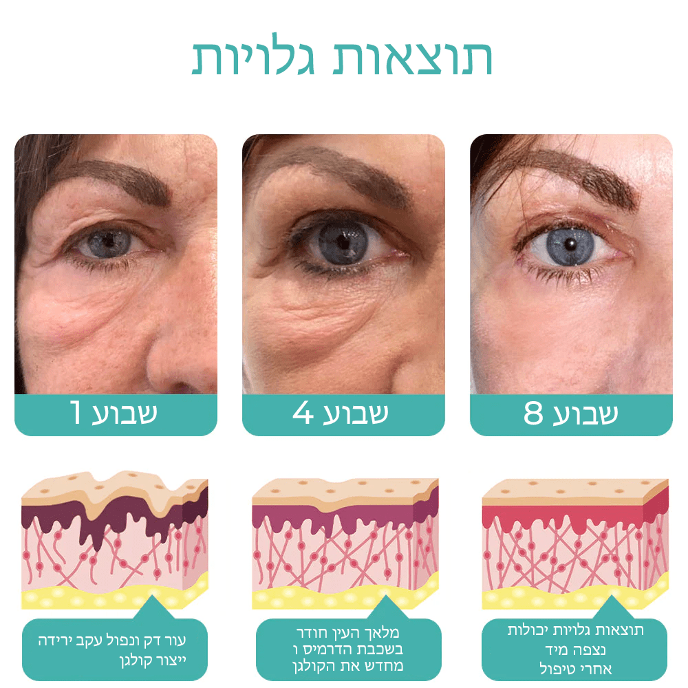 CellYoung™ | תמצית קרם עיניים פפטידית מחדשת!