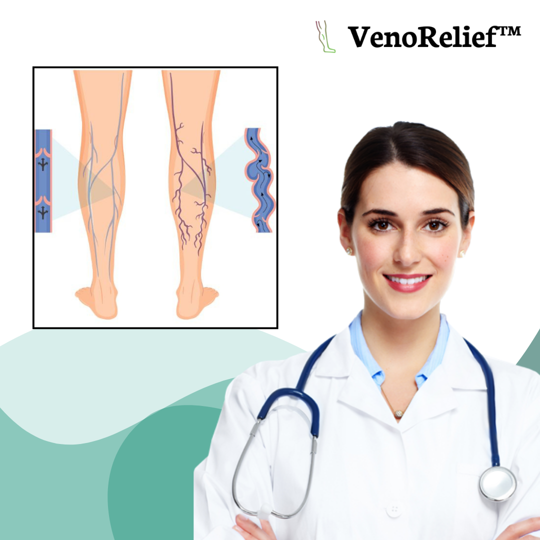 VenoRelief