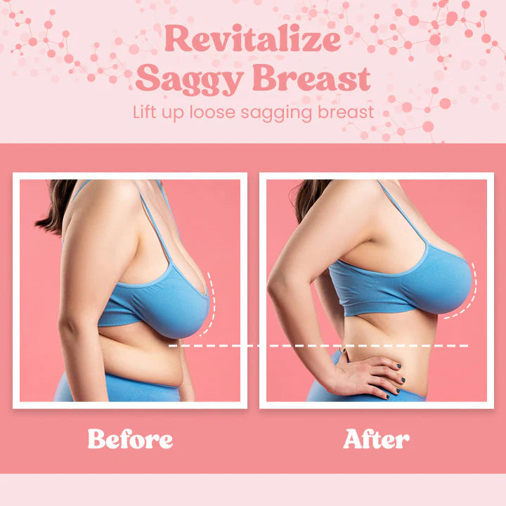 BosomLift™