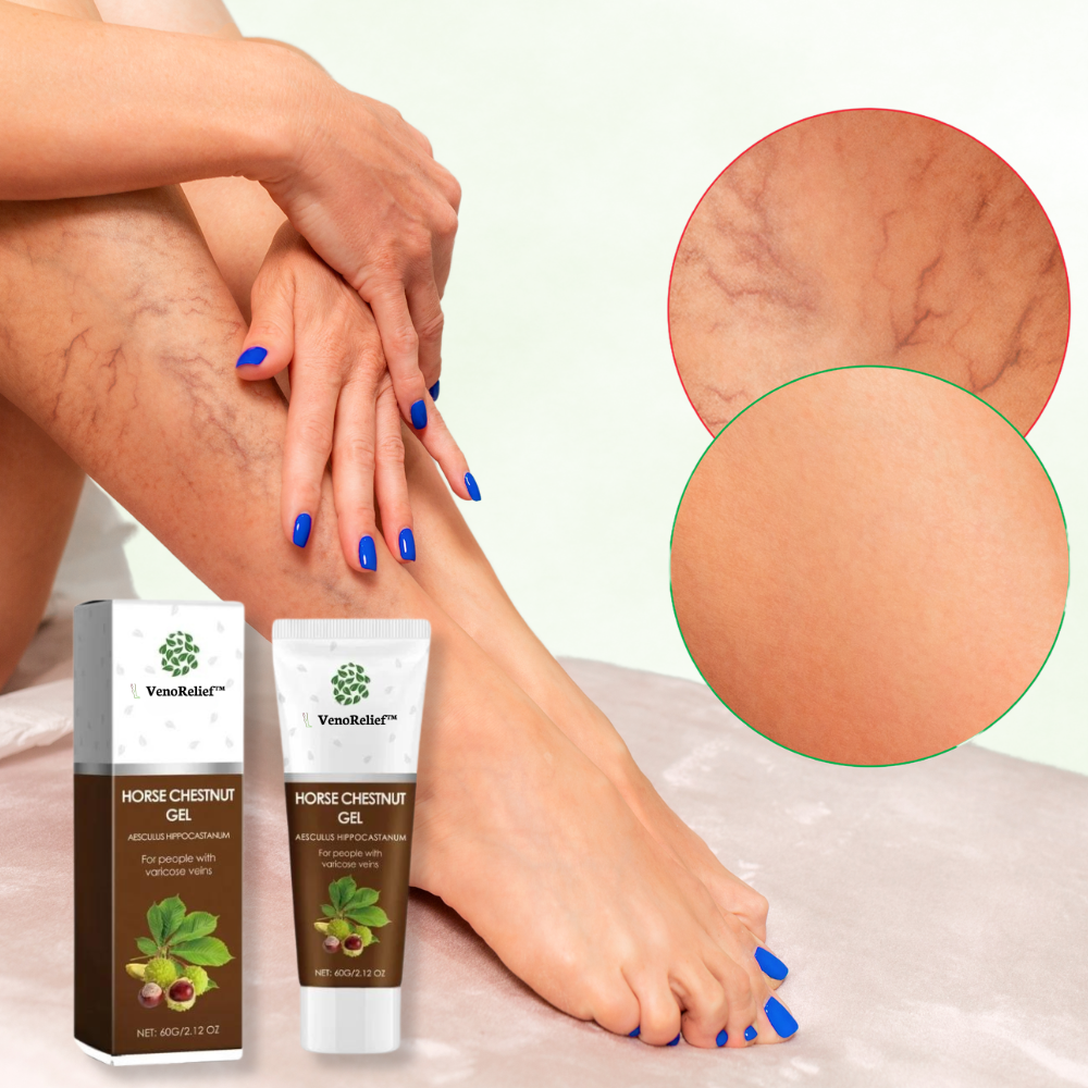 VenoRelief