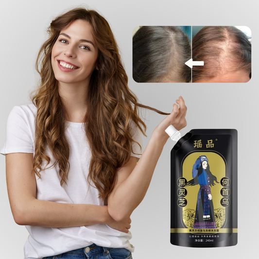 RootVital™ | להצמיח שיער פי 10 מהר יותר – לא עוד קרחות, לא עוד דילול!