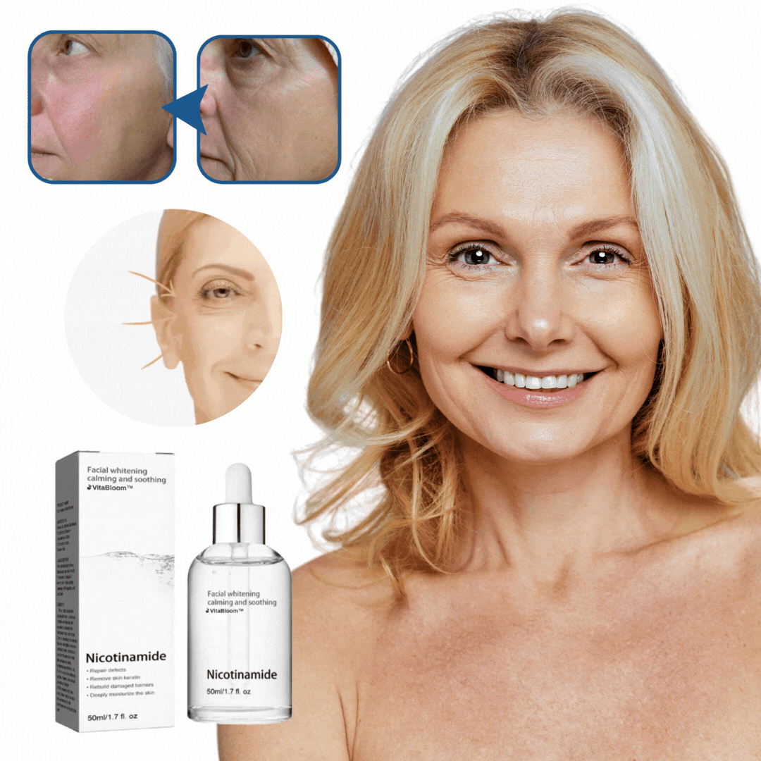 VitaBloom™ | מפחית קמטים ומבהיר את גוון העור ב-92% – תוך 7 ימים בלבד!