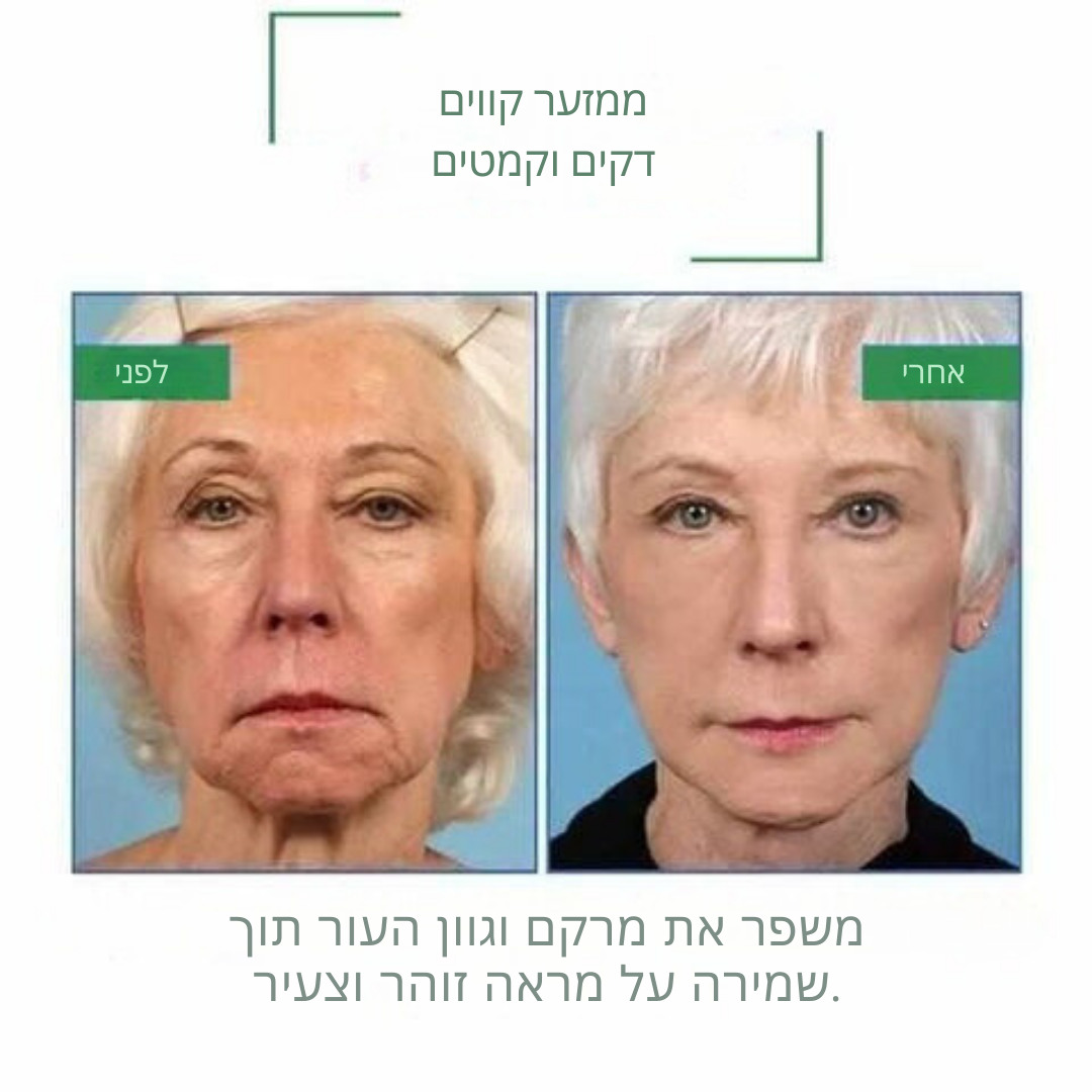 VitaBloom™ | מפחית קמטים ומבהיר את גוון העור ב-92% – תוך 7 ימים בלבד!